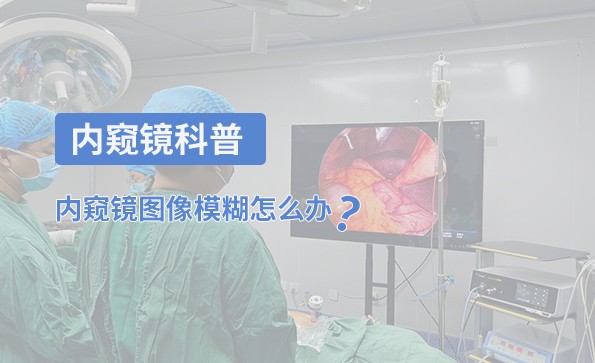內(nèi)窺鏡科普：內(nèi)窺鏡圖像模糊怎么辦？